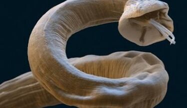 Ascaris parasite in the human body