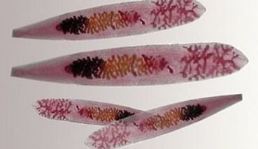 Opistorchis parasites in the human body