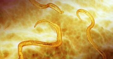 pinworms parasites in the human body