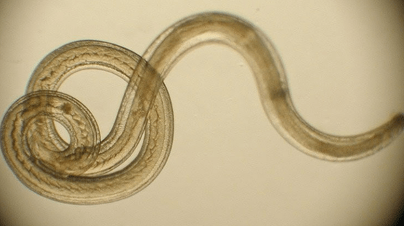a worm parasite of the human body