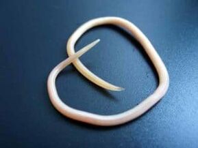 A human roundworm extracted from the body