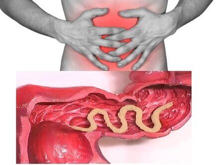 signs of chronic helminthiasis are dyspeptic bowel disorder