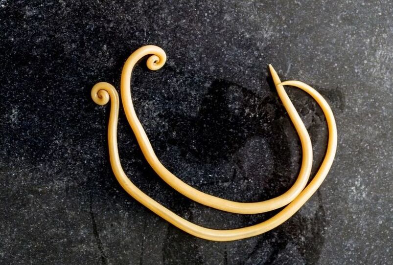Roundworms are the most common parasite in the human body