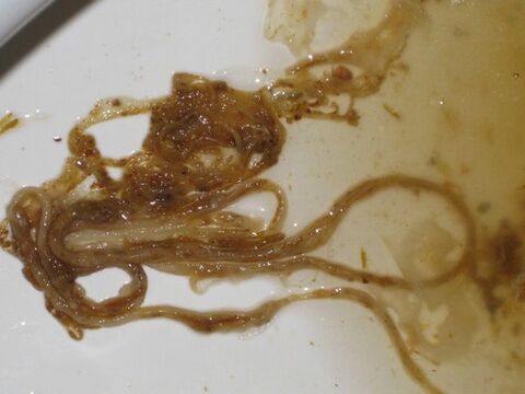 worms, parasites of the human body