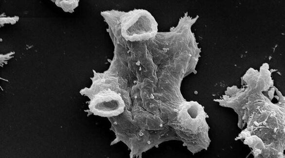 Negleria fowlera is a protozoan parasite that is dangerous to human life. 