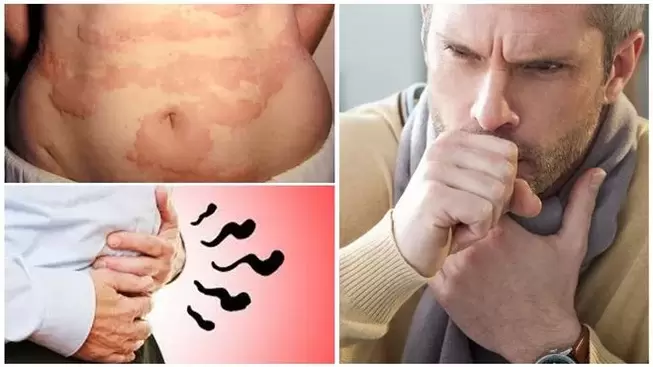 Allergies, coughs and bloating are signs of worm damage to the body