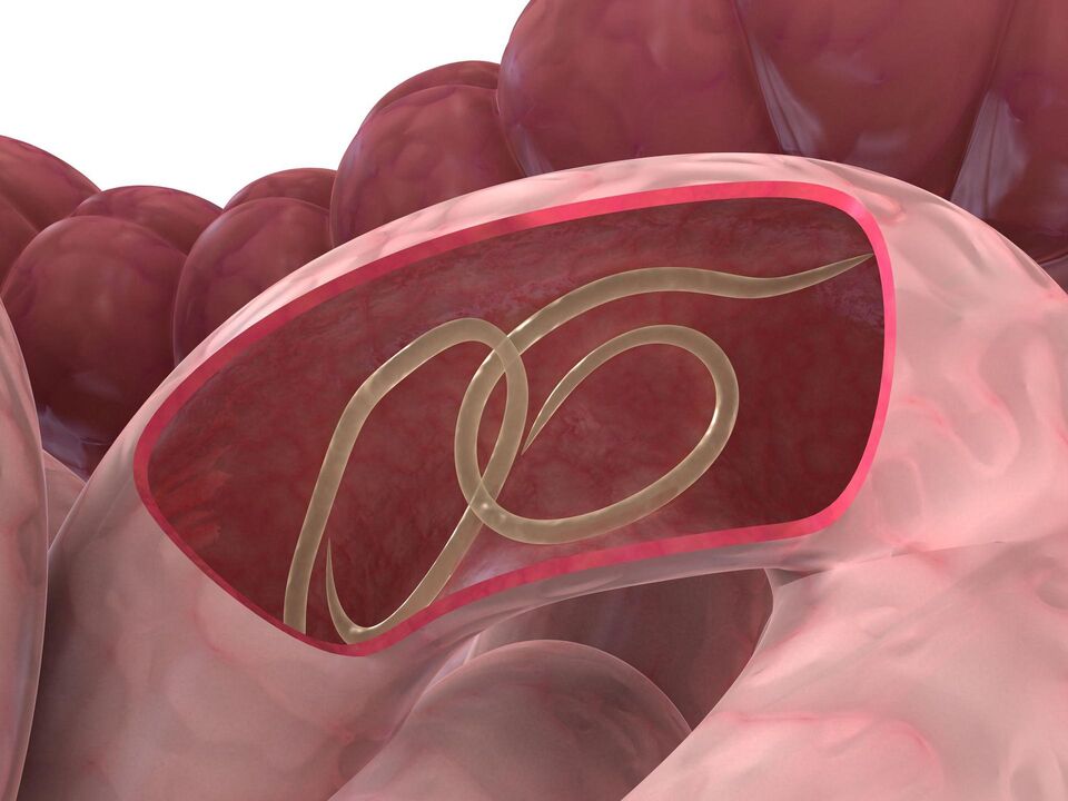 worm in the human intestine