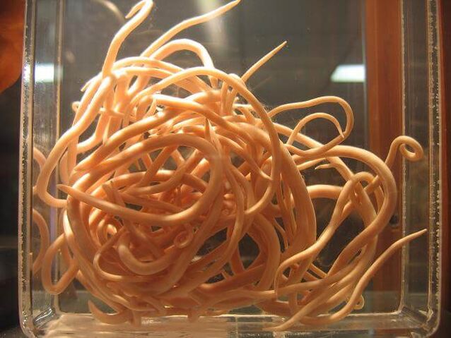 Roundworms are worms belonging to the nematode class. 