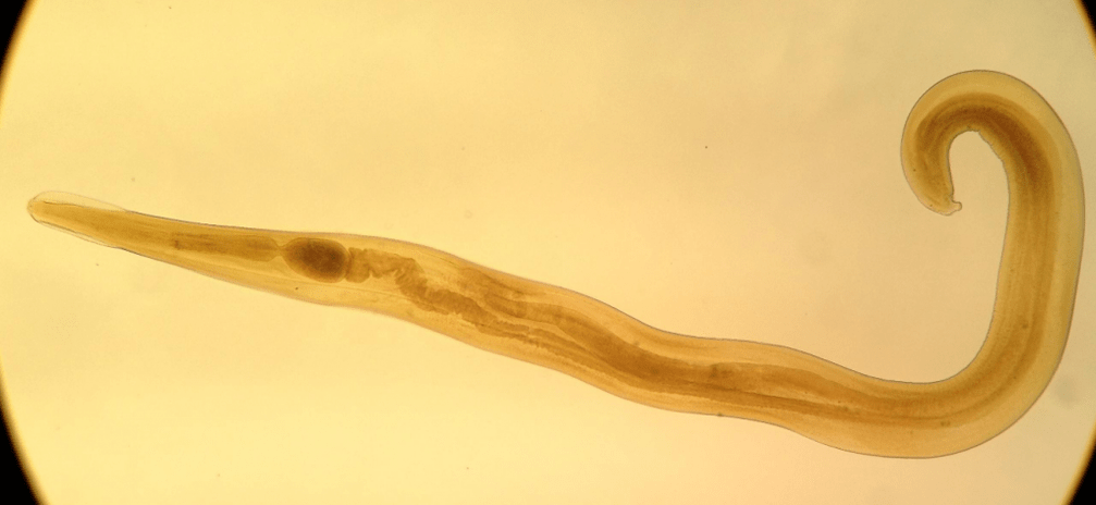Pinworm is a common parasite among children. 